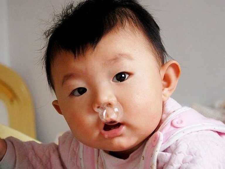trẻ sơ sinh bị sổ mũi nghẹt mũi - nhận biết